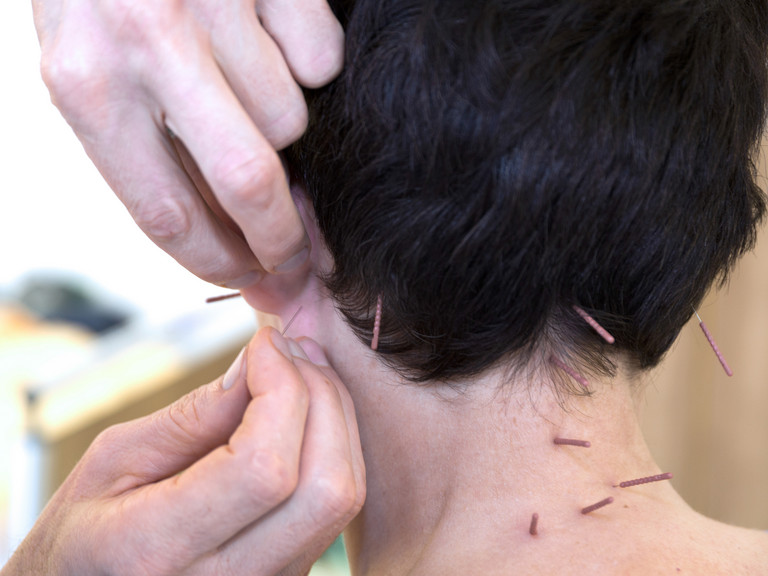 Akupunktur ist eine mögliche Therapie für Menschen mit chronischen Schmerzen im Schmerzzentrum Rüdersdorf